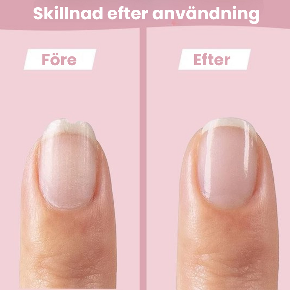 SafeCare – Tyst och säker – Elektrisk nagelfilsats för barn